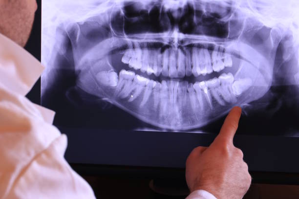 Best Emergency Gum Treatment in Ravenna, NE